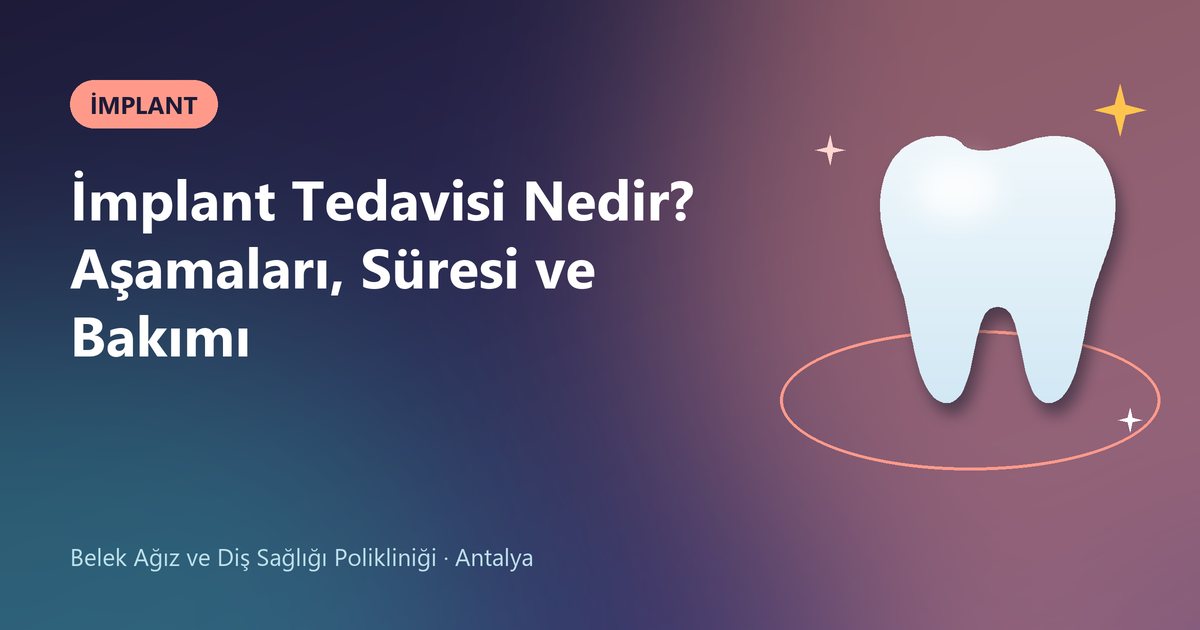 İmplant Tedavisi Nedir? Aşamaları, Süresi ve Bakımı – Belek Diş blog kapak görseli